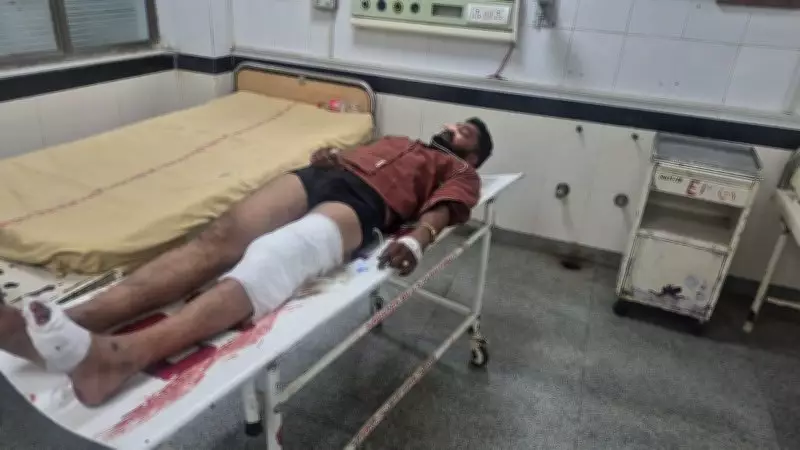 History Sheeter Nabbed After Encounter in Nuh, Cop Injured in Leg