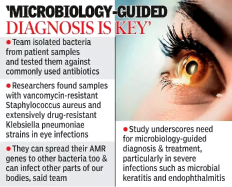 Hyderabad Study Reveals Alarming Rise in Drug-Resistant Eye Infections