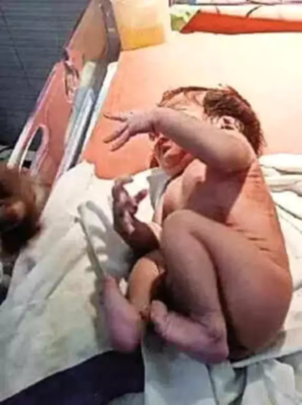 Low-Birth-Weight Baby Saved Under Mukh Mantri Sehat Yojana in Bathinda