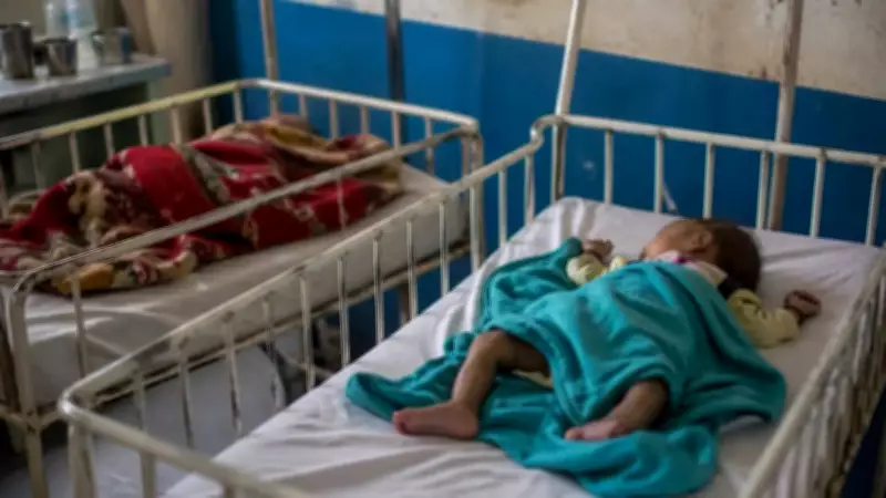 Malnutrition Death of Infant in Satna Highlights Rural Health Lapses