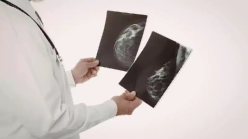 Mammograms May Reveal Hidden Heart Disease Risk in Women
