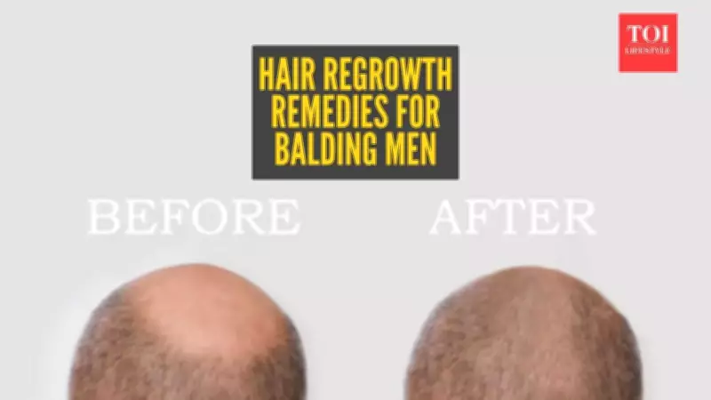 Natural Hair Regrowth for Men: Effective Home Remedies and Realistic Expectations