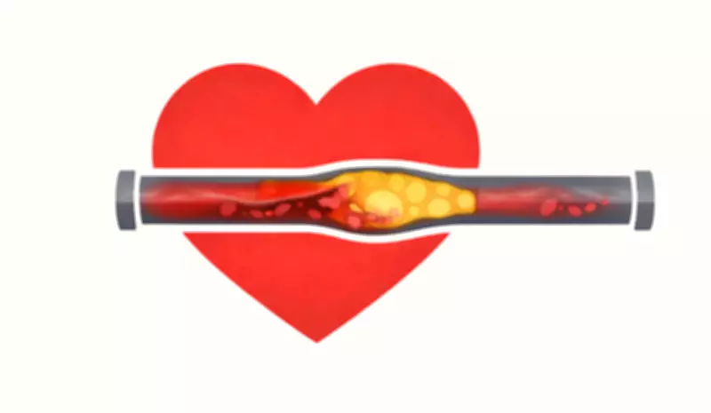 New AI Tool Reveals Most Heart Attacks Are Predictable, Not Sudden