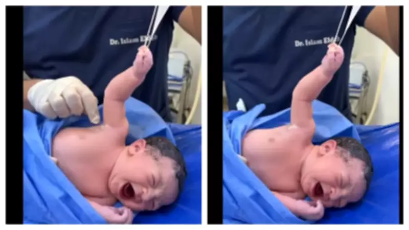 Newborn Baby's Adorable Grip on Doctor's Glove Goes Viral with 28M Views