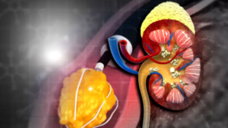 Oral Drug N-PPG Prevents Death in Mice with Rare Kidney Disease PH2