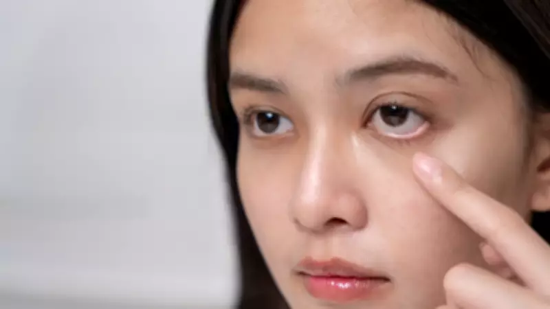 Persistent Puffy Eyes May Signal Kidney Trouble: When to Get Tested