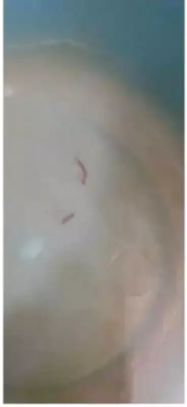 Pimpri Chinchwad Water Crisis: Residents Report Muddy, Sewage-Mixed Supply with Worms