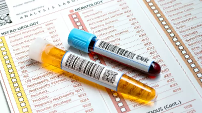 Pre-Disease Phase: Why Normal Lab Reports Hide Elevated Biomarkers in Youth