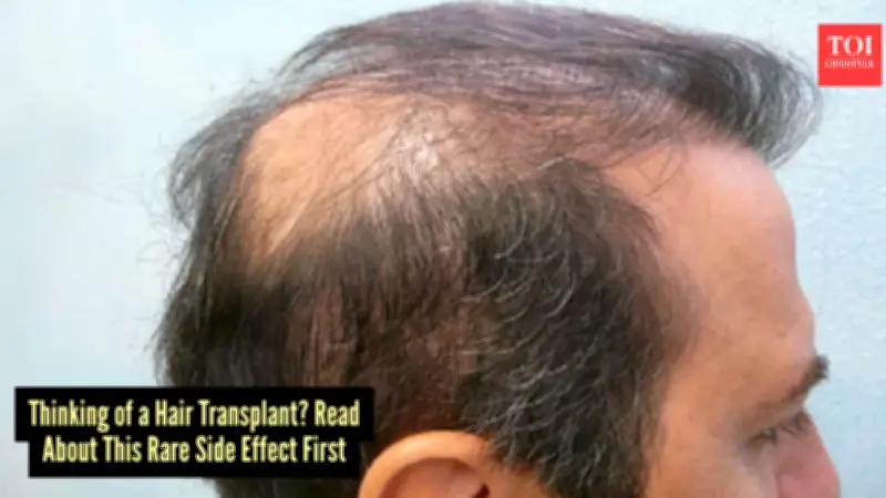 Rare Hair Transplant Complication Stuns Doctors Worldwide