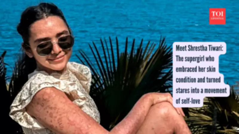 Shrestha Tiwari's Journey: Embracing Psoriasis and Redefining Beauty Standards