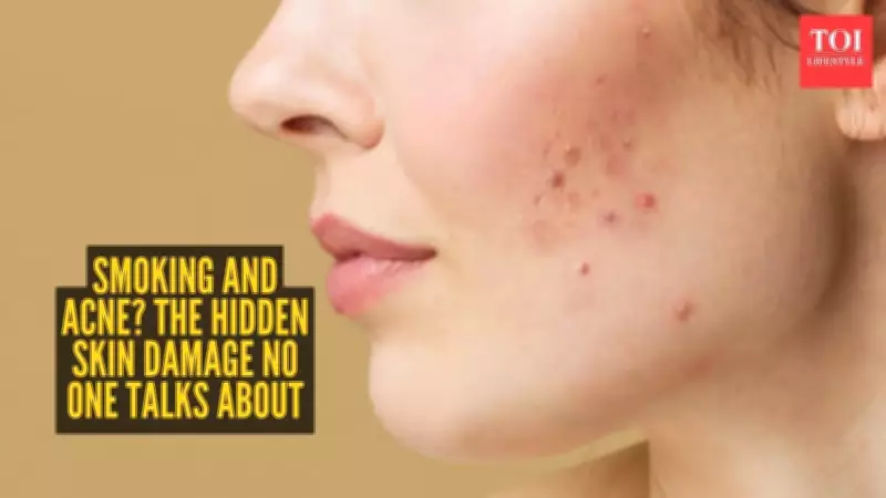 Smoker's Acne: How Cigarettes Sabotage Your Skin Health