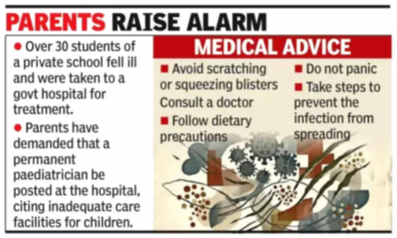 Somwarpet Parents Demand Permanent Pediatrician Amid Chickenpox Outbreak