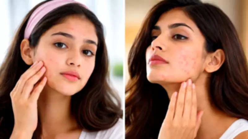 Teen vs Adult Acne: Key Differences and Comprehensive Treatment Guide
