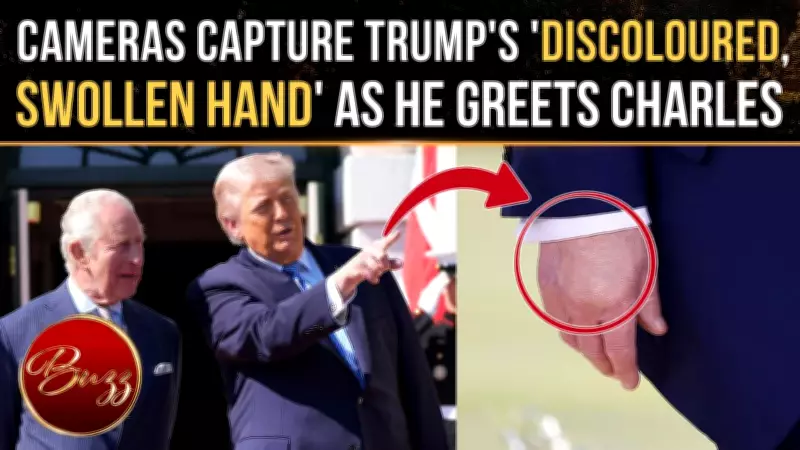 Trump's Discolored Hand Sparks Health Concerns During King Charles Visit