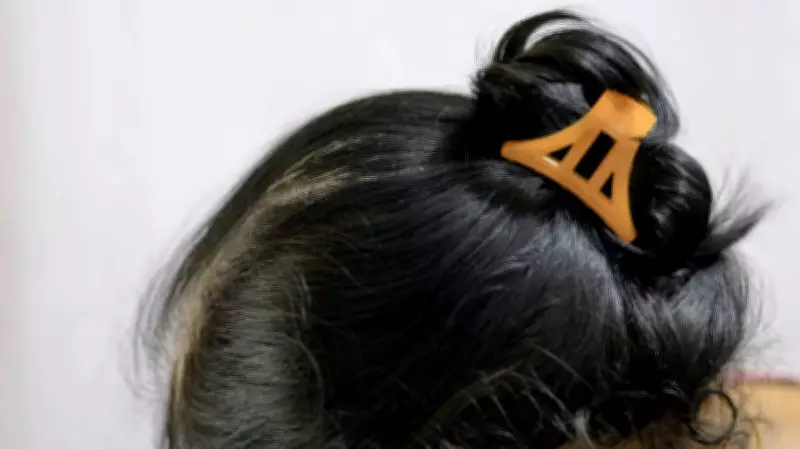 Uttar Pradesh Government Hospital Mandates Hair Bun, Bans Long Hair and Beards