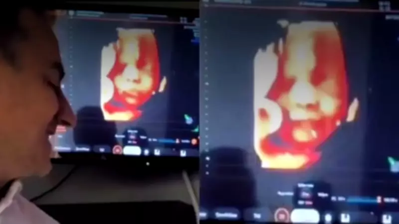 Viral Ultrasound Video Shows Unborn Baby Smiling at Father's Voice