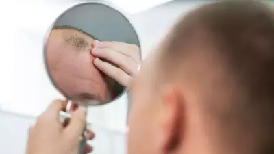 Finasteride for Hair Loss: DHT, Dosage, Side Effects, and Price Guide
