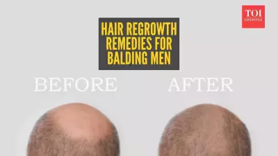 Natural Hair Regrowth for Men: Effective Home Remedies and Realistic Expectations