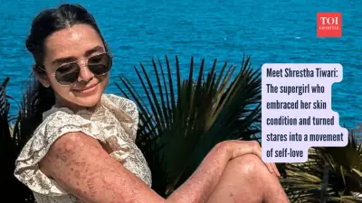 Shrestha Tiwari's Journey: Embracing Psoriasis and Redefining Beauty Standards