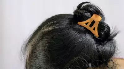 Uttar Pradesh Government Hospital Mandates Hair Bun, Bans Long Hair and Beards