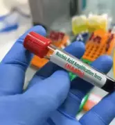 AIIMS Mangalagiri Boosts Blood Safety with New NATS and TTI Diagnostic Systems