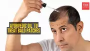 Ayurvedic Oil Routine for Bald Spots: A 30-Day Natural Regrowth Guide