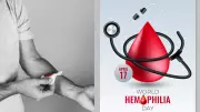 Essential Hemophilia Management: Daily Care Tips and Lifestyle Precautions