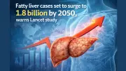 Global Fatty Liver Crisis: 1.3 Billion Affected, 1.8 Billion Projected by 2050