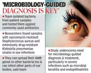 Hyderabad Study Reveals Alarming Rise in Drug-Resistant Eye Infections
