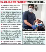 Navi Mumbai Doctor Saves Life Using Dialysis Catheter in Rural Emergency