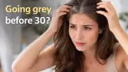 Premature Grey Hair in Your 20s: Causes, Prevention, and Expert Advice