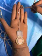 Pune Girl Hears for First Time with Future-Ready Smart Cochlear Implant