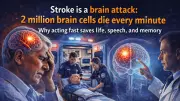 Stroke is a 'Brain Attack': Every Minute Without Treatment Kills 2 Million Brain Cells