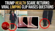 Trump's Health Under Renewed Scrutiny After Viral Limping Video Sparks Concern