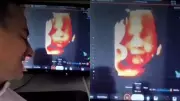 Viral Ultrasound Video Shows Unborn Baby Smiling at Father's Voice