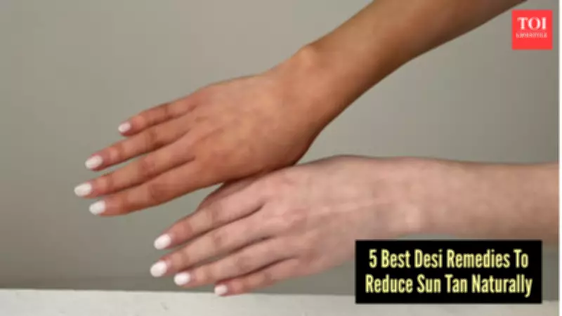 5 Desi Home Remedies to Remove Stubborn Tan Fast This Summer