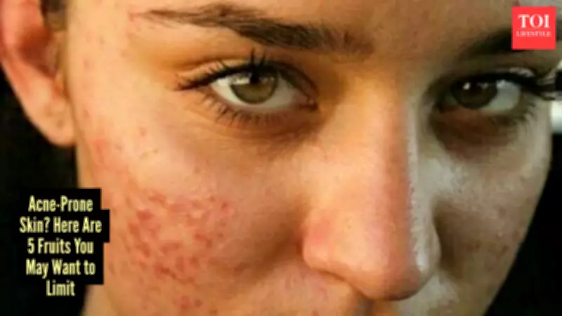 5 Fruits That Could Be Triggering Your Acne Breakouts