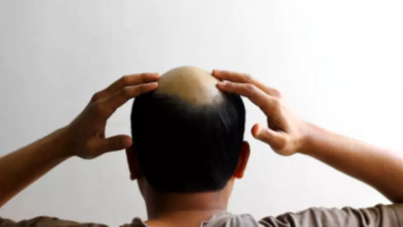 7 Natural Supplements That Could Help Slow Hair Loss: Expert Insights