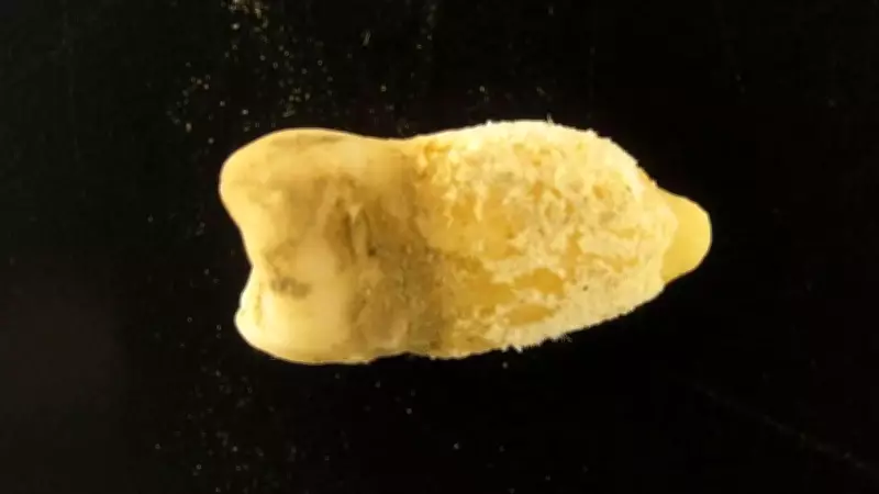 700-Year-Old Mummy Tooth Reveals Ancient Scarlet Fever Bacterium in Bolivia