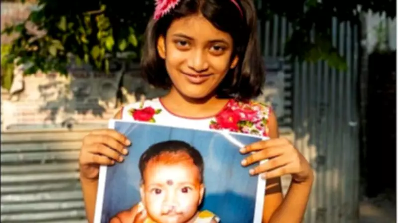 90% Feel More Socially Accepted After Cleft Surgeries, Study Finds