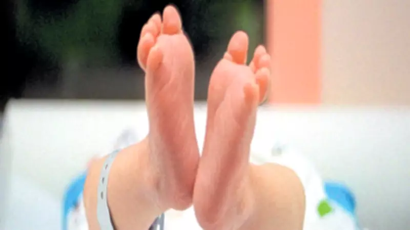 Bengaluru Hospital Performs 11,500 Free Cleft Lip Surgeries
