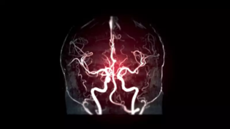 Cerebral Angiography: Vital Test for Brain Vascular Health