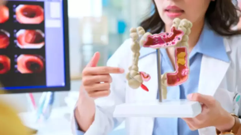 Colon Cancer in Young Adults: Harvard Doctor Lists 4 Early Warning Signs