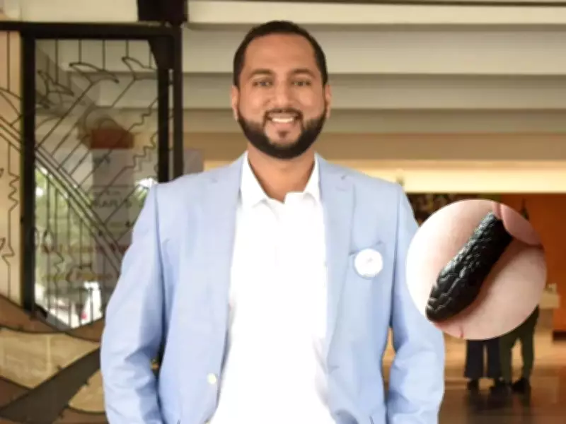 Congress Candidate Ketan Bhatikar Dies After Snakebite in Karnataka