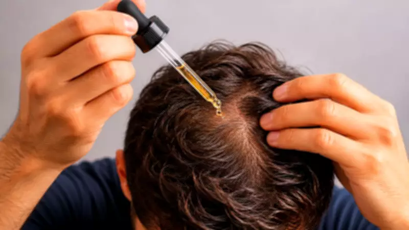 Finasteride and Minoxidil for Hair Loss: Can They Trigger Depression or Anxiety? Dermatologist Explains