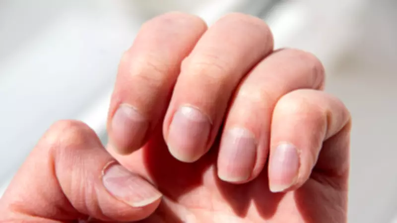 Fingernail Health Signs: What Your Nails Reveal About Your Body