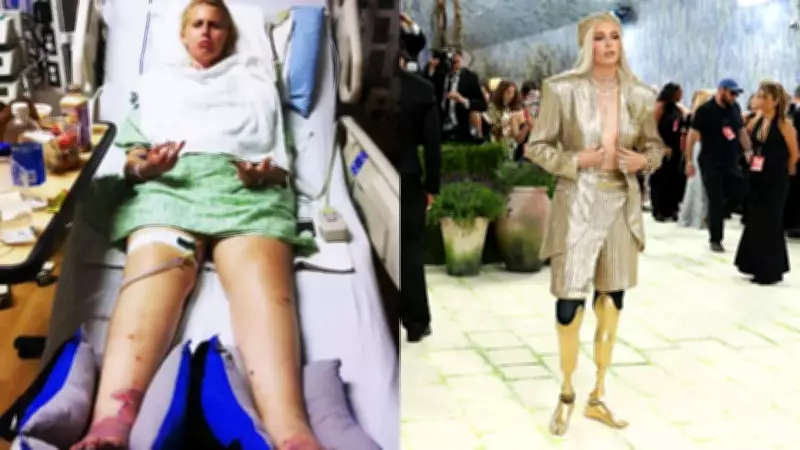 Golden Legs Model Lauren Wasser's Tragic Tampon Story at Met Gala 2026