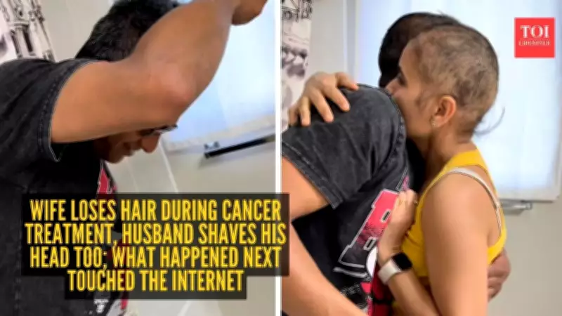 Husband Shaves Head to Support Wife During Cancer Treatment