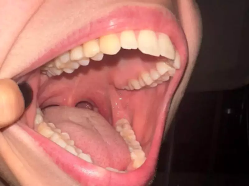 Japanese Scientists Begin Human Trials for Tooth Regrowth Drug TRG-035