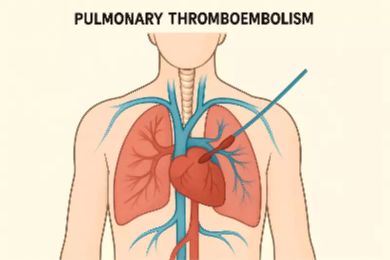 Low Awareness of Life-Saving Pulmonary Thromboendarterectomy Surgery in India